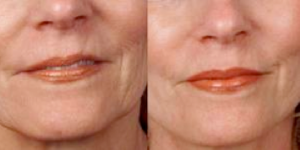 Screen-Shot-2013-02-04-at-3.34.55-AM-300x150