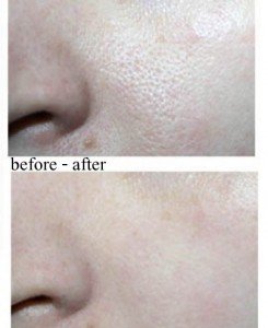 tonymoly-egg-pore-silky-smooth-balm-primer_before-after