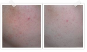 chicaychico_totas3.0_detail_01