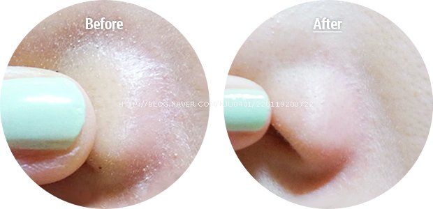 cosrx_blackheadsilkfingerball_beforeafter