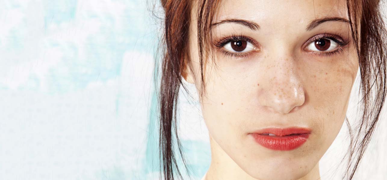 home-remedies-for-dark-spots-on-face